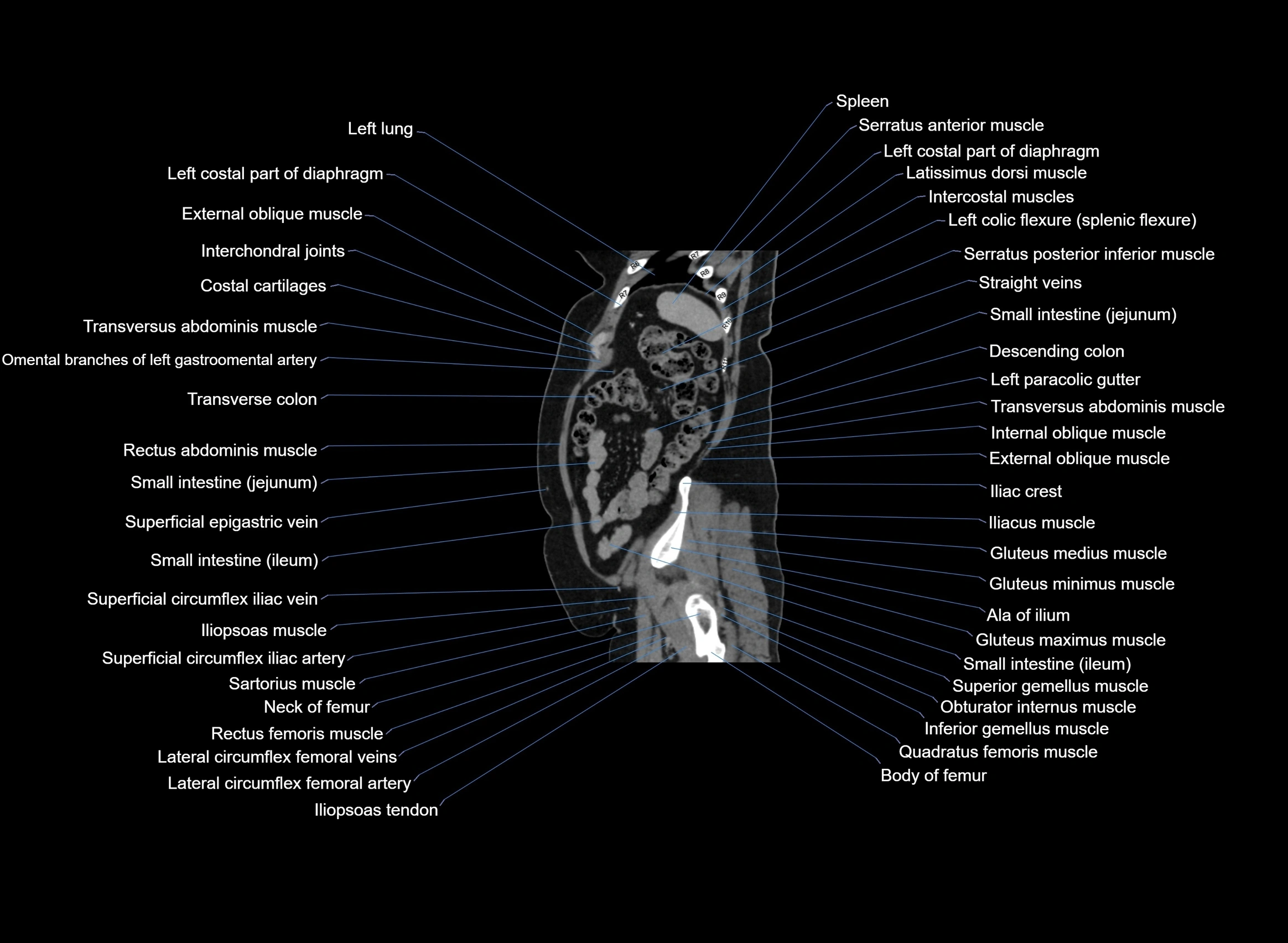 CT Abdomen sagittal cross sectional anatomy labelled radiology image -00022.webp